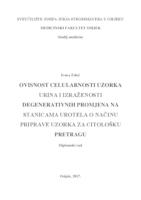 Ovisnost celularnosti uzorka urina i izraženosti degenerativnih promjena na stanicama urotela o načinu priprave uzorka za citološku pretragu