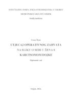 prikaz prve stranice dokumenta Utjecaj operativnog zahvata na sliku o sebi u žena s karcinomom dojke